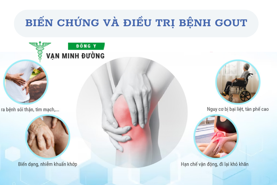 điều trị bệnh gout