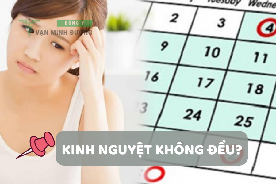 Kinh nguyệt không đều là gì