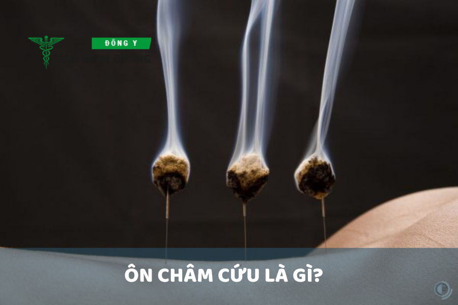 Ôn châm cứu là g?