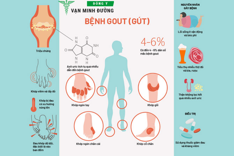 nguyên nhân, triệu chứng bệnh gout