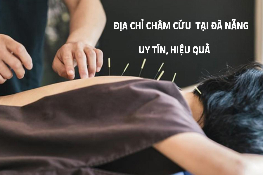 ĐỊA CHỈ CHÂM CỨU TẠI ĐÀ NẴNG UY TÍN, HIỆU QUẢ