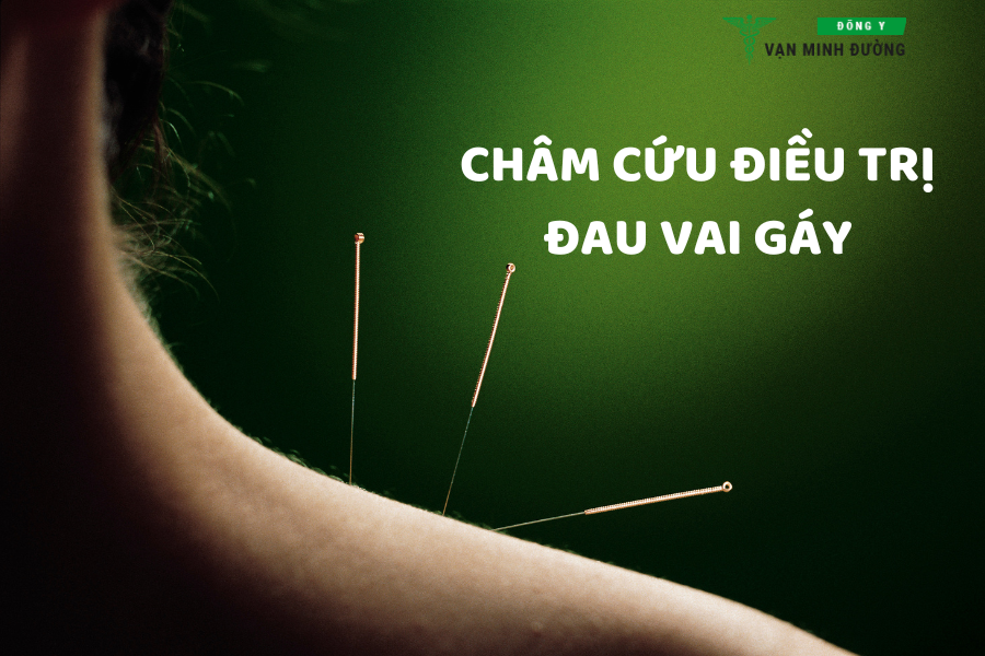 Châm cứu điều trị đau vai gáy