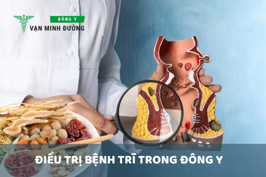 Điều trị bệnh trĩ trong Đông y