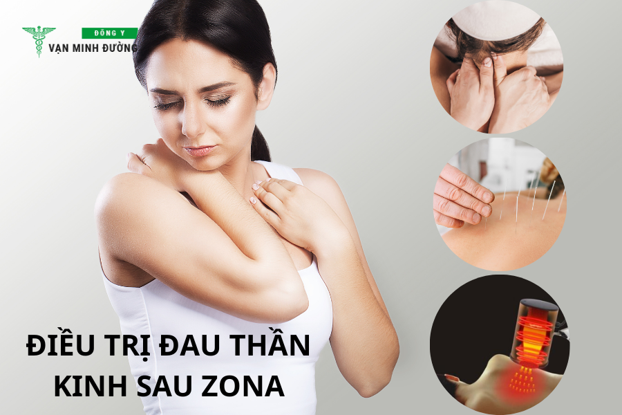 Điều trị đau thần kinh sau zona