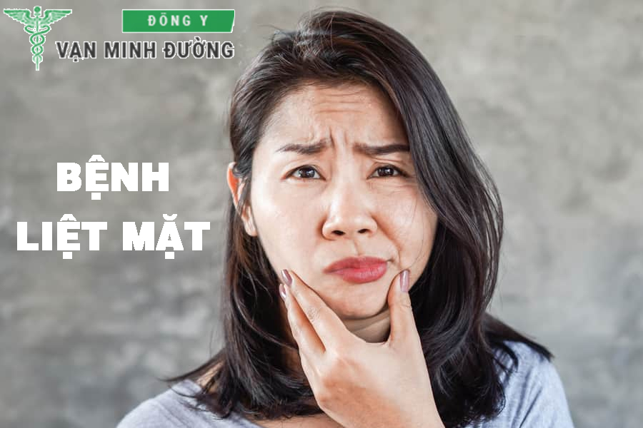 Chữa liệt dây thần kinh số 7 bằng Đông y