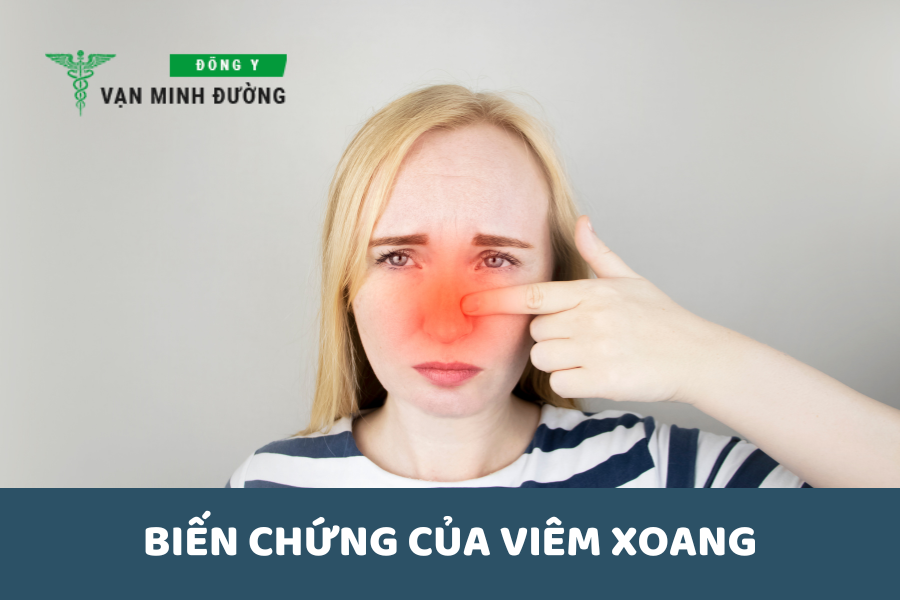 Biến chứng của viêm xoang thường gặp