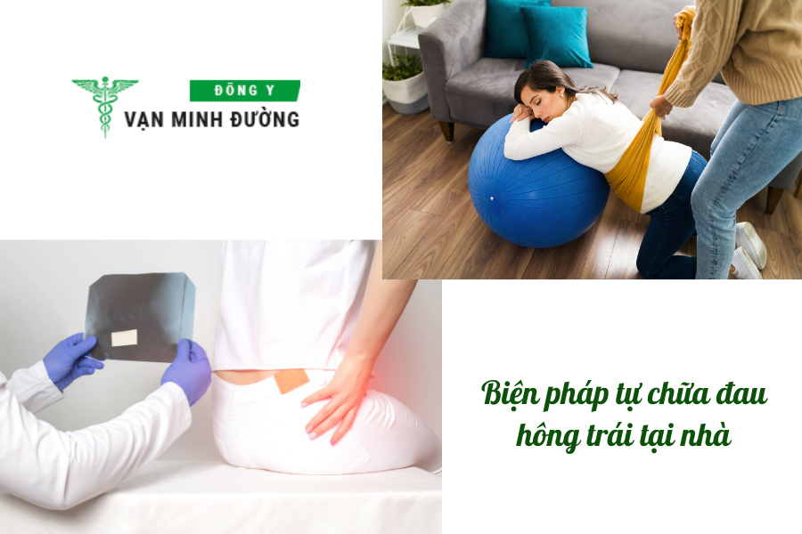 Biện pháp tự chữa đau hông trái tại nhà hiệu quả