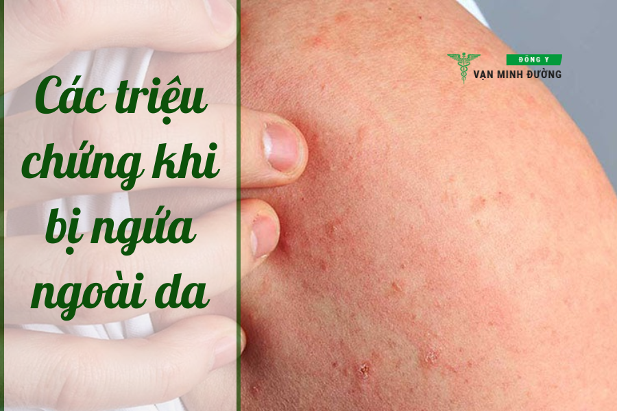 Các triệu chứng thường gặp khi bị ngứa ngoài da