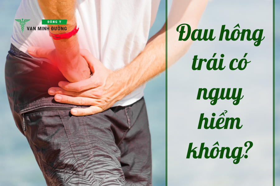 Đau hông trái có nguy hiểm không