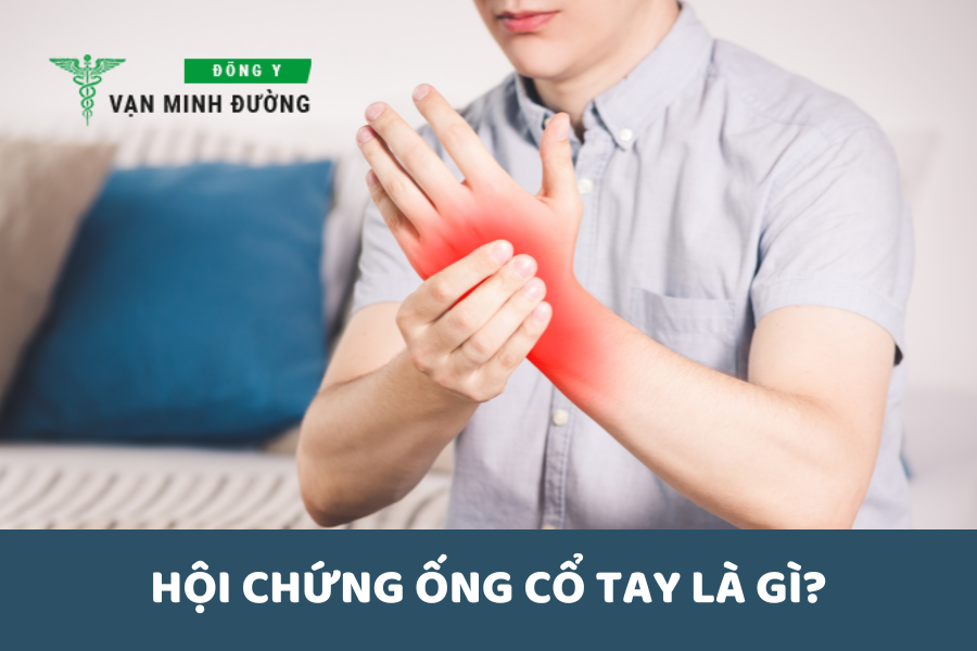 Hội chứng ống cổ tay là gì