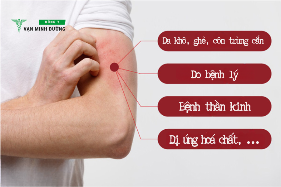 Nguyên nhân gây ngứa ngoài da