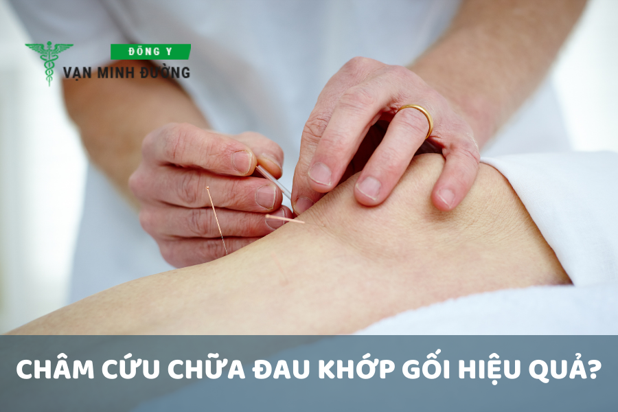 Châm cứu chữa đau khớp gối