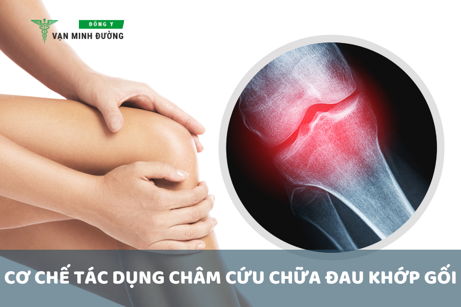 Cơ chế tác dụng của châm cứu chữa đau khớp gối