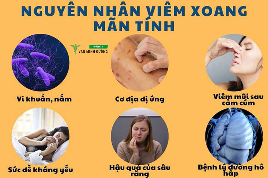 Nguyên nhân