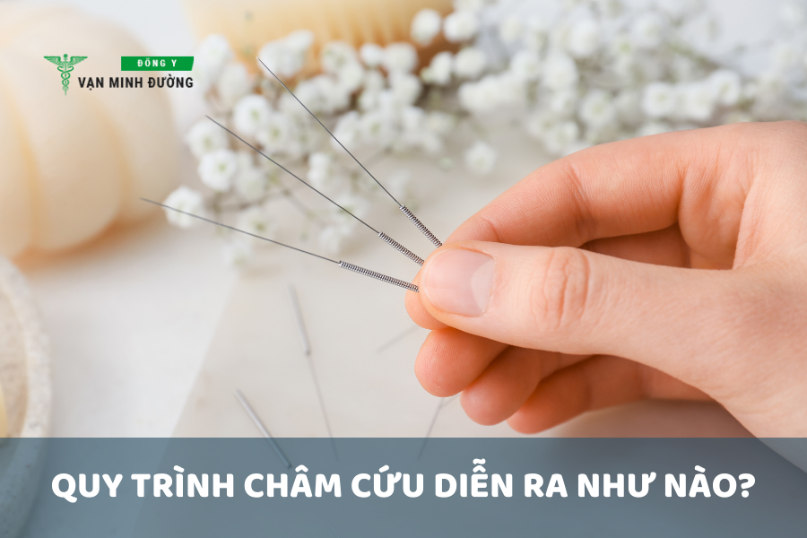 Quy trình châm cứu diễn ra như nào
